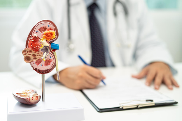 What Are Kidney Function Tests? Understanding Their Importance