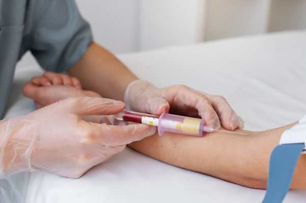 Unlocking the Mysteries of Your Digestive System: Gut Health Blood Tests Explained