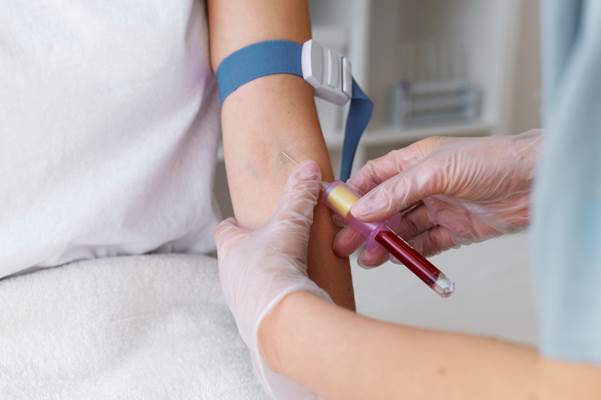 Understanding Diabetes Screening Tests: What You Need to Know
