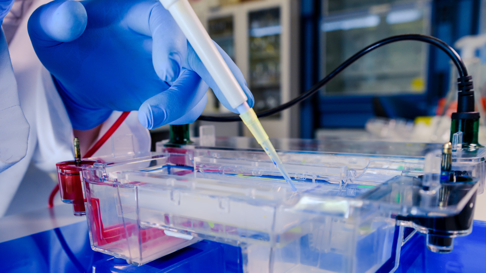 Understanding Electrophoresis (Protein and Haemoglobin)