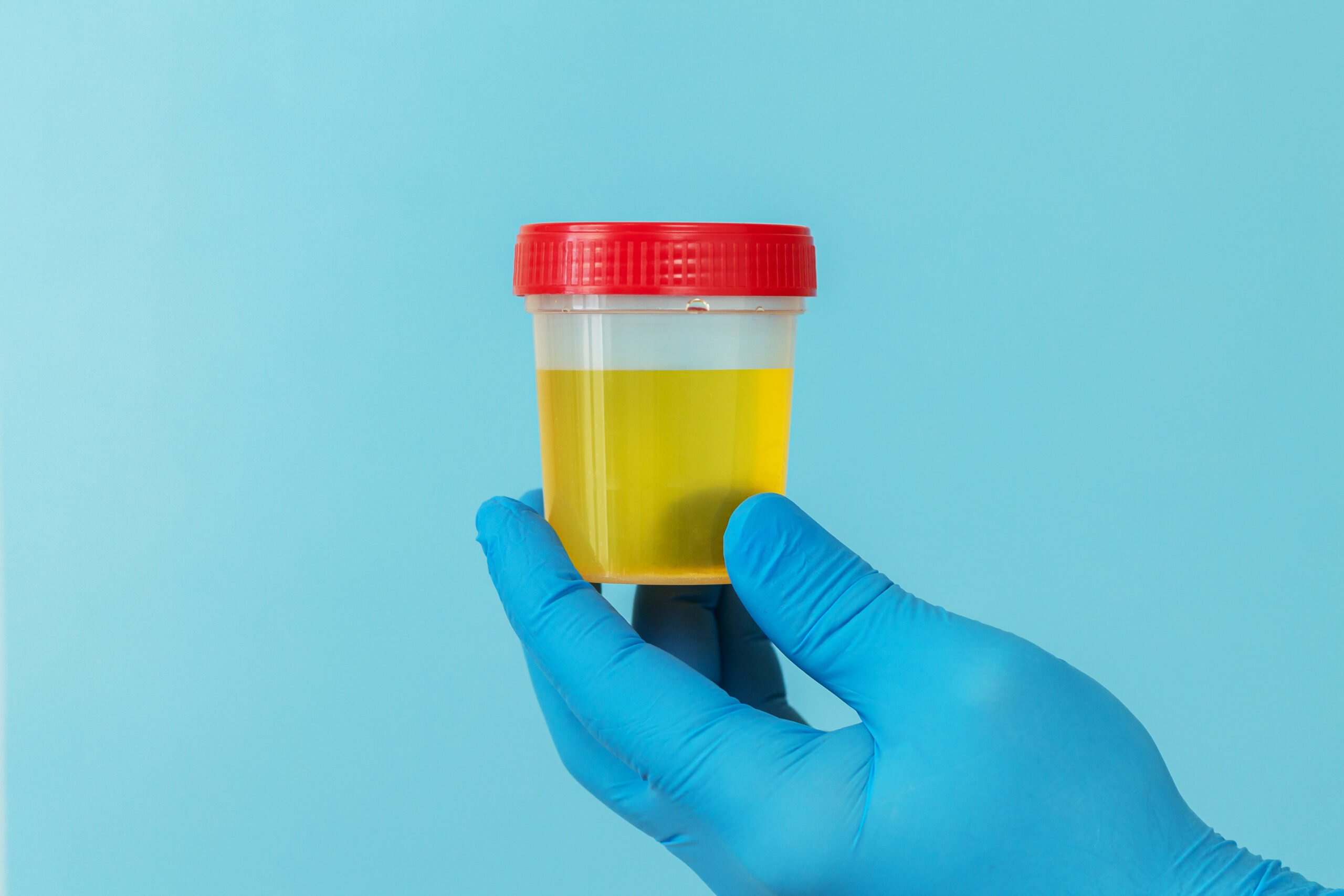 Understanding the Creatinine Clearance Test: Purpose, Procedure, and Results