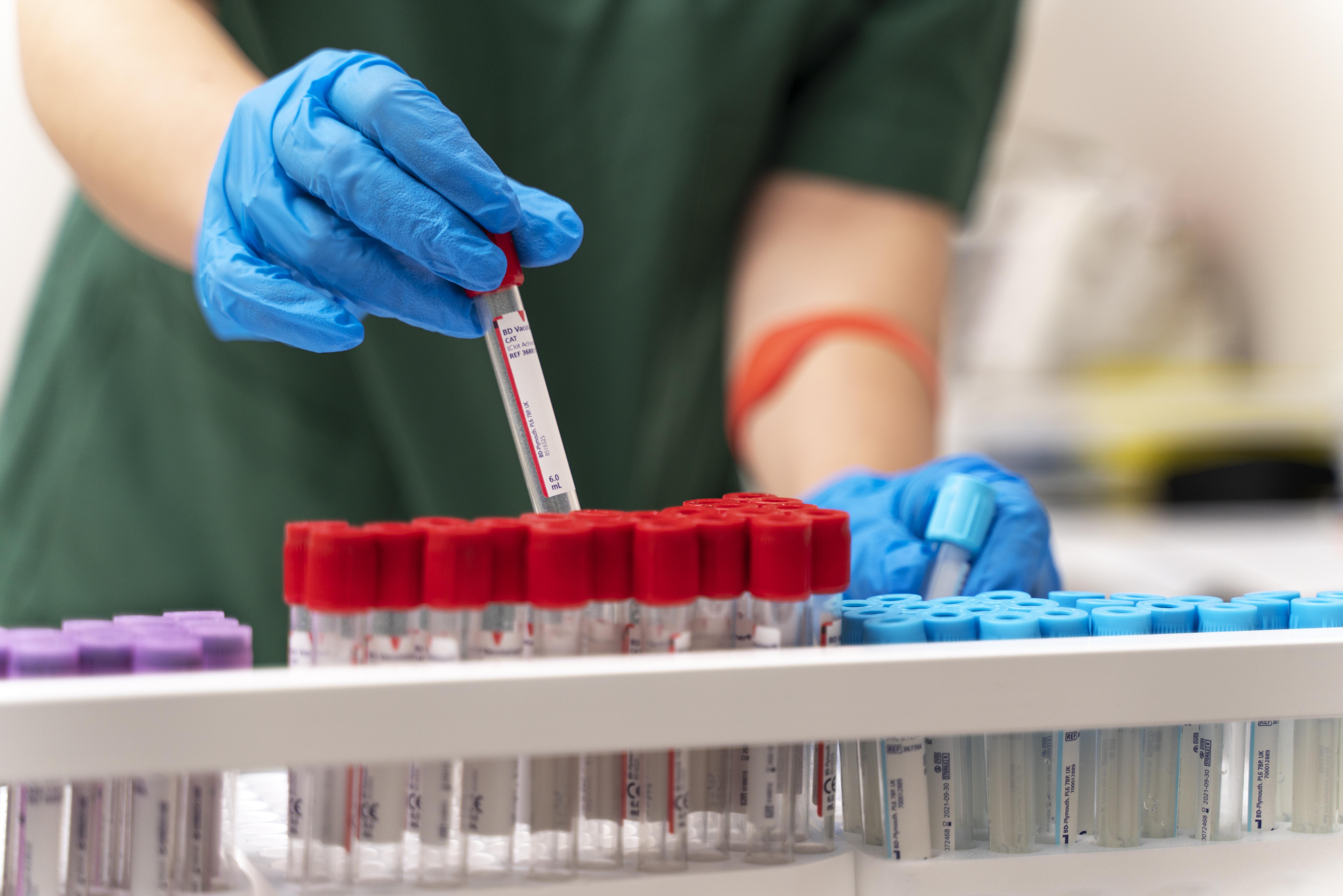 Understanding Reticulocyte Count: What It Is and Why the Test Matters